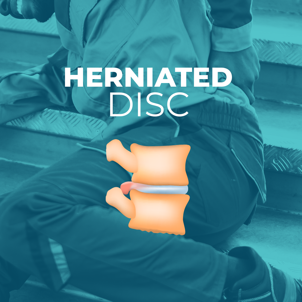 Bulging Disc vs. Herniated Disc
