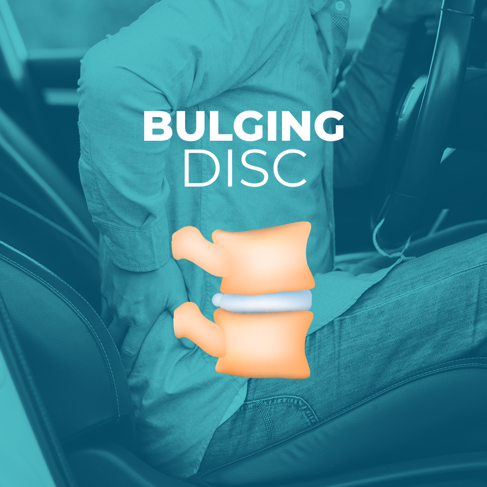 Bulging Disc vs. Herniated Disc
